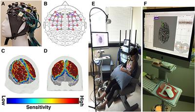 Using Functional Near-Infrared Spectroscopy to Study the Effect of Repetitive Transcranial Magnetic Stimulation in Concussion: A Two-Patient Case Study